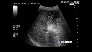 CASE 58