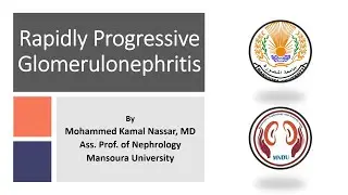 Rapid Progressive Glomerulonephritis - Anti-GBM Disease - Prof. Mohammed Kamal Nassar - 9.6.2022