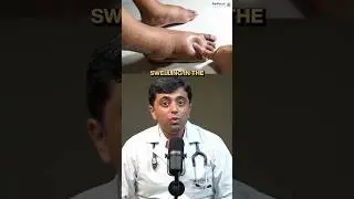 What are your swollen legs telling you?