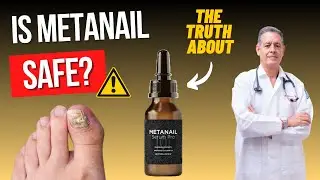 🔴 Metanail Complex REVIEW 🔴 Metanail Serum Pro Results ⚠️ Metanail Serum Pro Works? - METANAIL