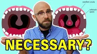 What Do Tonsils Actually Do and Why are We Constantly Removing Them