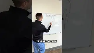 How to fix a heart attack #FYP #Doctor #Nurse #Student #Education