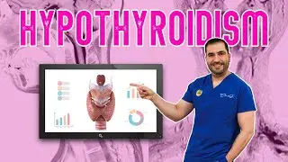 Hypothyroidism | Gastric Sleeve Surgery | Questions and Answers
