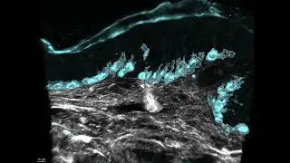 JID October Cover Video: Melanocyte-Keratinocyte Interactions in the Epidermis