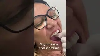 Pr&oacute;tese dent&aacute;ria superior com protocolo inferior
