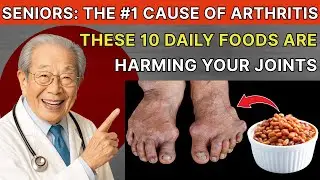 Seniors: The Worst 10 Foods for Arthritis, Never Eat These Foods Again! |Senior Health Tips