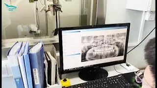 Dental Equipment Manufacture 3D Digital CBCT Panoramic Cephlometric Imaging Dental X-ray Supply