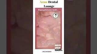 Stop grinding your teeth know why with | Teeth Grinding (Bruxism)