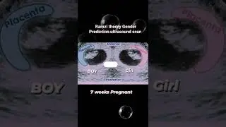 Ramzi Theory Gender Prediction Ultrasound Scan #shortsfeed #mother #motherhood #pregnancy
