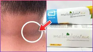 Top 3 BEST Creams For Men With Dark Neck! #dermatologist #darkneck #cream #skinwhitening
