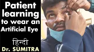 How to : Patient learning to wear an artificial eye | Dr Sumitra