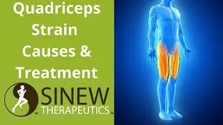 Quadriceps Strain Causes and Treatment