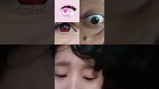 eye Loop 4 parision
