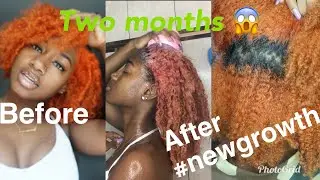 How to Grow your Hair FAST!!!| VanityPlanet Scalp Massager