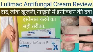 Lulimac Cream Uses in Hindi. Lulimac Cream for Fungal Infection. Lulimac Cream ke Fayde.
