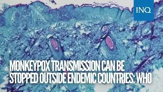 Monkeypox transmission can be stopped outside endemic countries: WHO