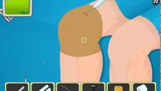 Operate Now: Knee Surgery Walkthrough