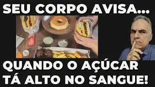 Sinais de que você está com açúcar alto no sangue! Cuidado!