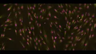 Wide-field fluorescence microscopy  of the dividing fibroblasts