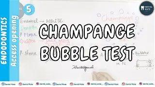 Champange bubble test | Color change guide | RCT | Access Opening | Dr Paridhi Agrawal