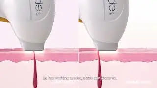 Primelase Laser Hair Reduction - Diode Laser Platform with Power of 3 Wavelengths