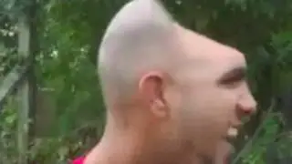 Half head man is real.