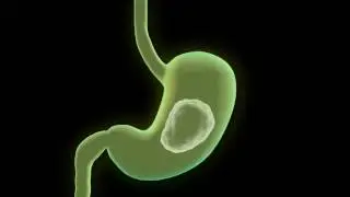stomach girl3