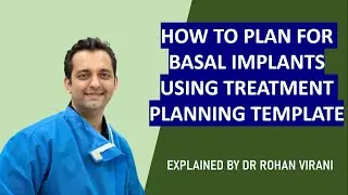 HOW TO PLAN FOR BASAL IMPLANTS USING TREATMENT PLANNING TEMPLATE - EXPLAINED BY DR ROHAN VIRANI