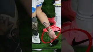messi's ankle 😱  #argentina vs #colombia