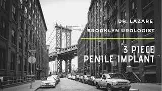 3 Piece Penile Implant | Dr. Jon Lazare, Urologist