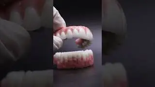 IPS e.max ZirCAD Prime Fixed Arch