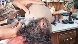 Бритье головы 🔥 Сколько перхоти удаляется полностью? Привлекательная голова без перхоти 🔥
