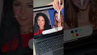 ¿Cuántas cirugías estéticas tiene Shakira? - Qué se hizo Shakira  en la cara #cirugiaplastica