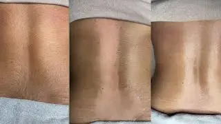 Pre Bridal waxing tutorial/Back waxing step by step #skincare #beauty #waxing#pummybeautyworld