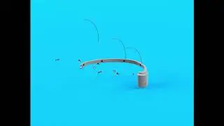 Wearable EEG device to monitor and track brain activity