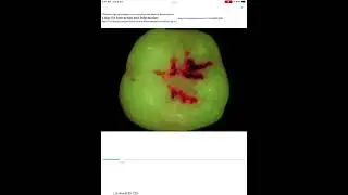 SmartPhone iOralForens App for Forensic Dental Identification Using WiFi Wireless Intra-Oral Cameras
