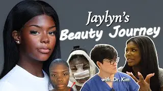 I Changed My Entire Face&hellip; (Full Plastic Surgery Journey)