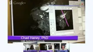 deSTEMBER live MRI