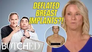 5 WEIRD Botched Breasts | Botched | E!