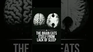 Can Your Brain Eat Itself from Sleep Deprivation?