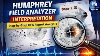 Humphrey Field Analyzer interpretation | step by step procedure to read HFA report |