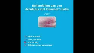 Behandeling van een decubitus met Flaminal&reg; Hydro.