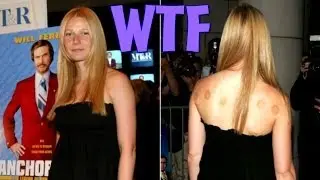 Hollywood's Bizzare Health Secrets