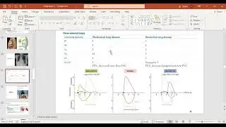 USMLE ATP STEP1 EXPRESS COURSE: Obstructive vs Restrictive lung patterns & Flow volume curves.