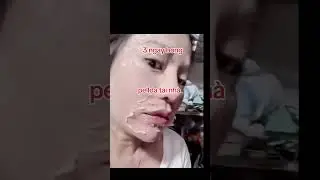pelk bong sau 3 ng&agrave;y b&ocirc;i tại nh&agrave; #0967254448 #taitaoda #pelldasinhhoc #canada #xuhung