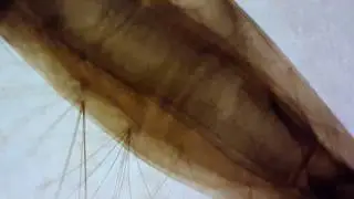 Culex quinquefasciatus larva(1)