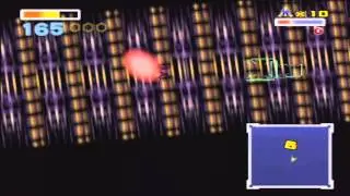 Hardest Boss Battles #79 - Andross Brain