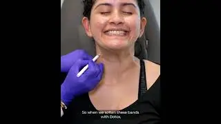 Botox Neck Lift
