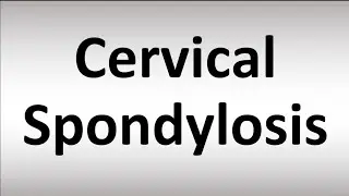 Relieve neck pain naturally 💆&zwj;♂️Daily exercises for cervical spondylosis = , more comfort!