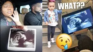 VLOG: SCARY MOMENT DURING BABY ULTRASOUND APPOINTMENT! + Anatomy Scan & Pics